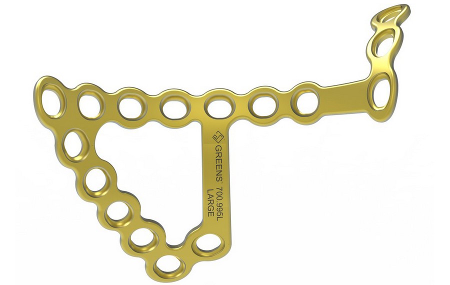 INFRAPECTINEAL PLATE 